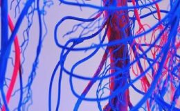 Damar Tikanıklarını Önlemenin 7 Etkili Yolu!